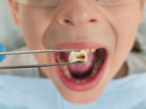 Best Broken Tooth Emergency  in North Crossett, AR